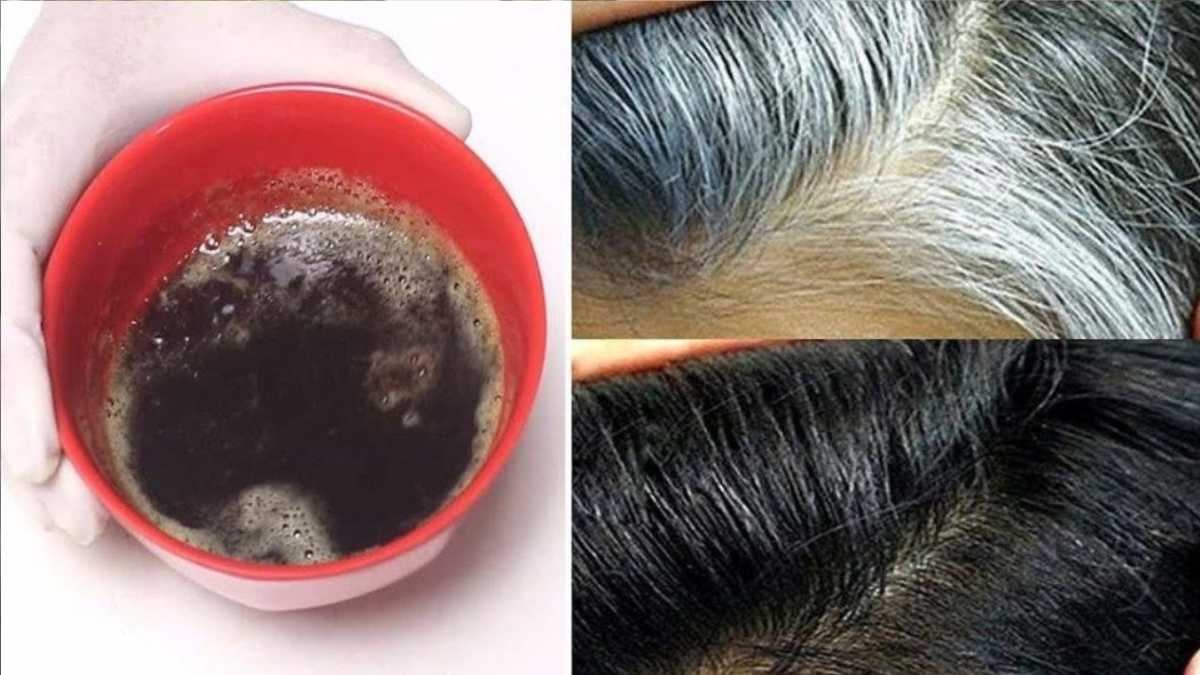 Natural Remedies to Get Rid of White Hair at Young Age 
