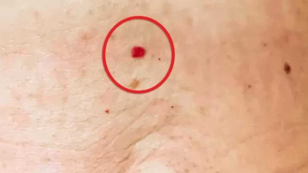 what-can-cause-red-dots-to-appear-on-the-skin-granny-tricks