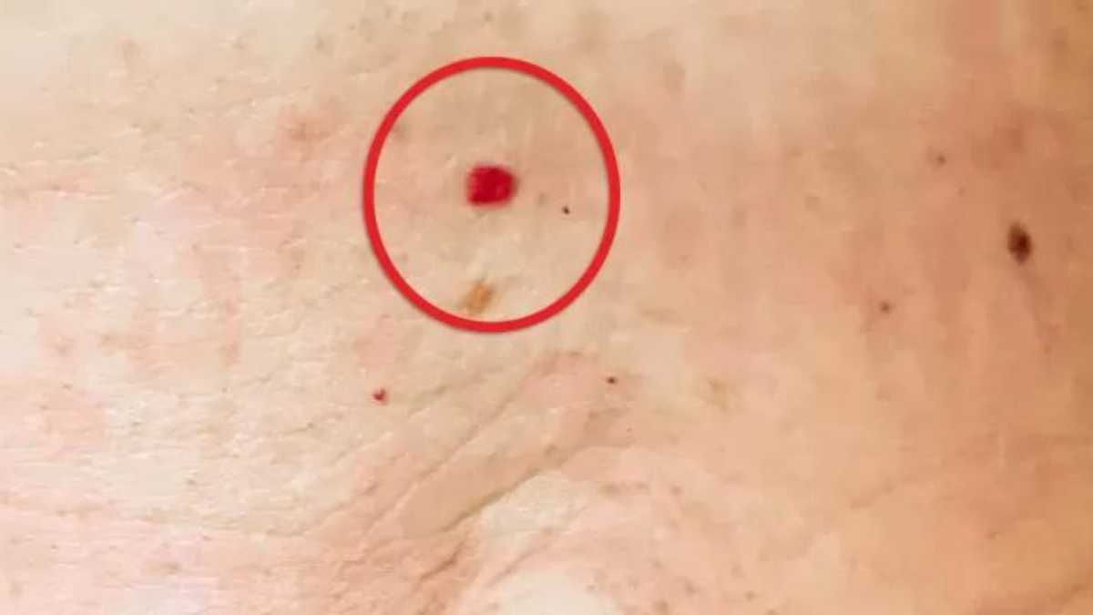 What can cause red dots to appear on the skin?