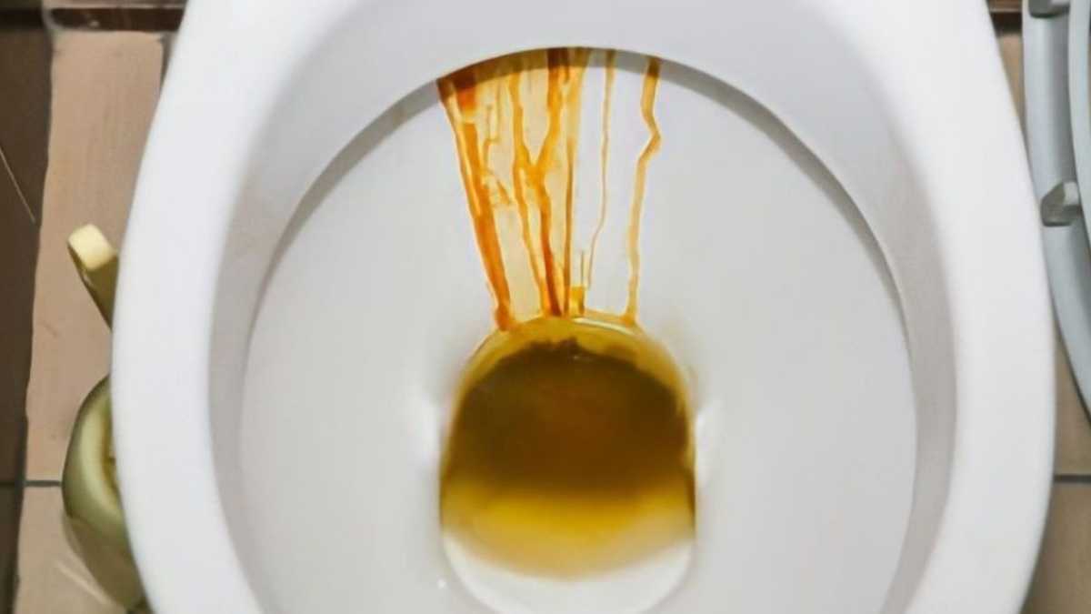 How to Remove Hard Water Brown Stains from Toilet?