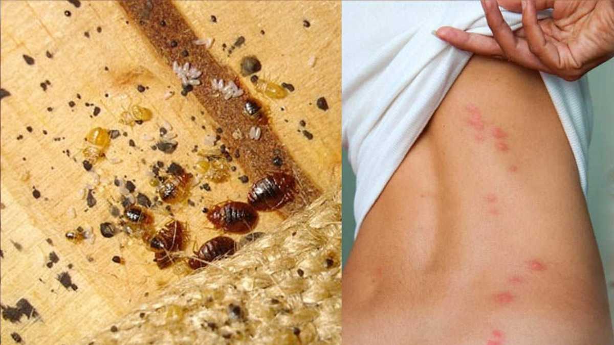 Bedbugs: Here's Where They Hide in the House Even Before the Mattress