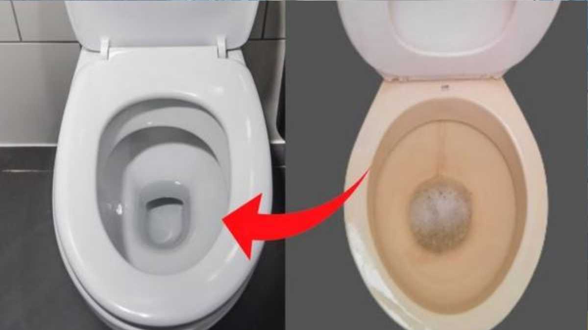 How to Clean a Calcified Toilet?