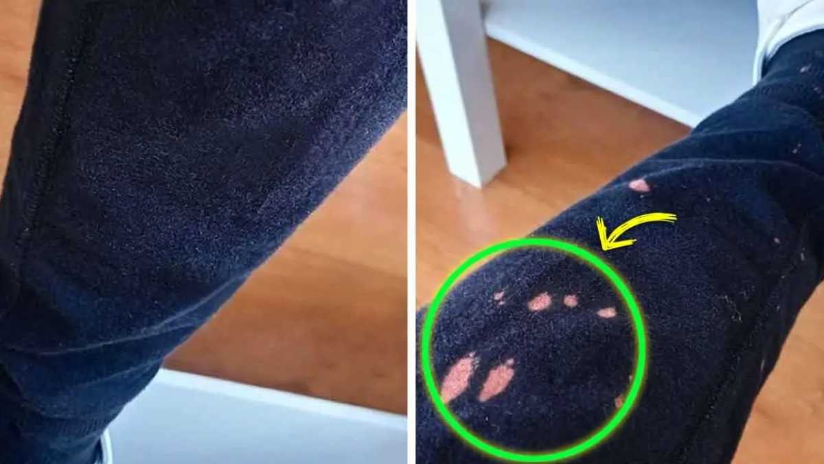 How to quickly and easily remove bleach stains from clothes